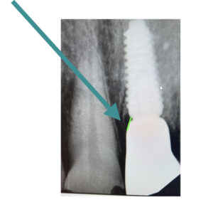 Case study: abutment design 6 Abutment