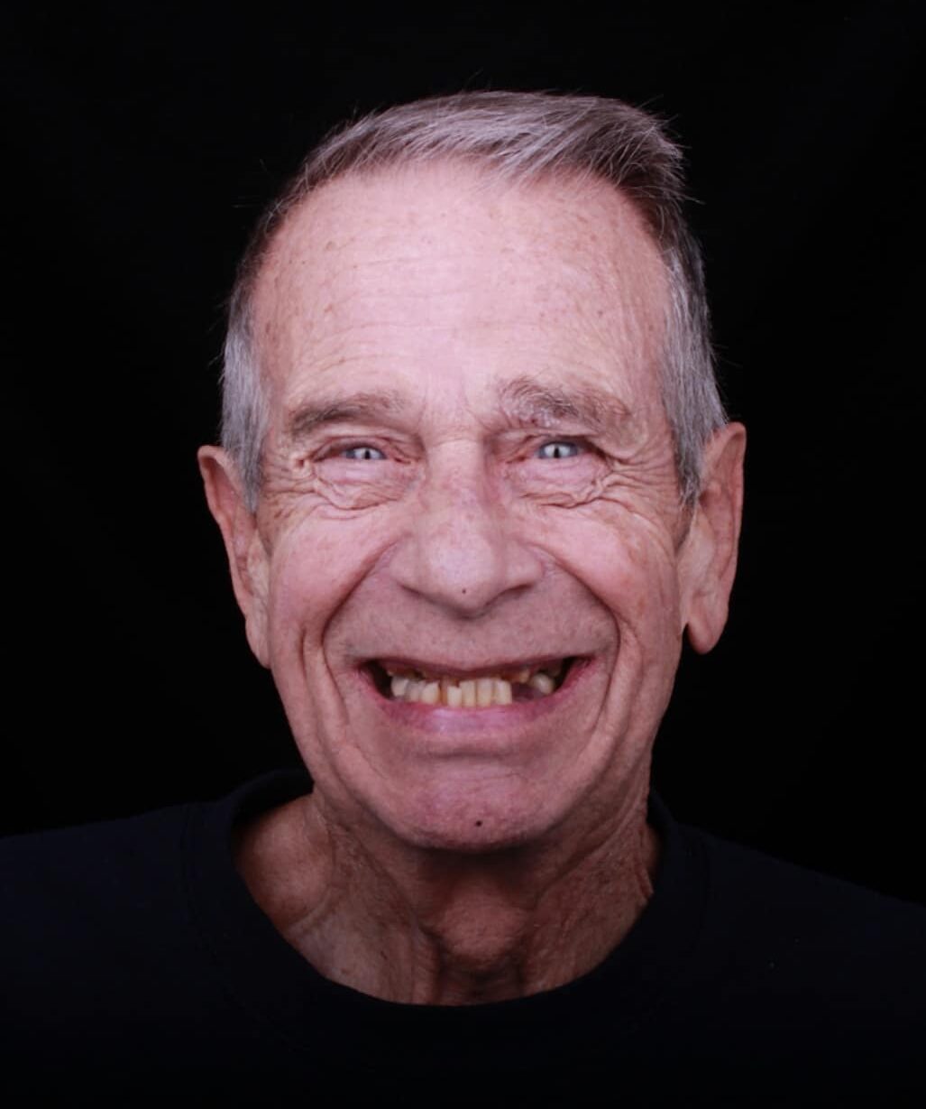 Life changing dentistry 2 Jerry smiling before transformation