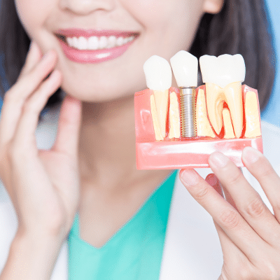 Your guide to the dental implant journey: from start to finish 11 A woman holding a model of teeth showing a dental implant
