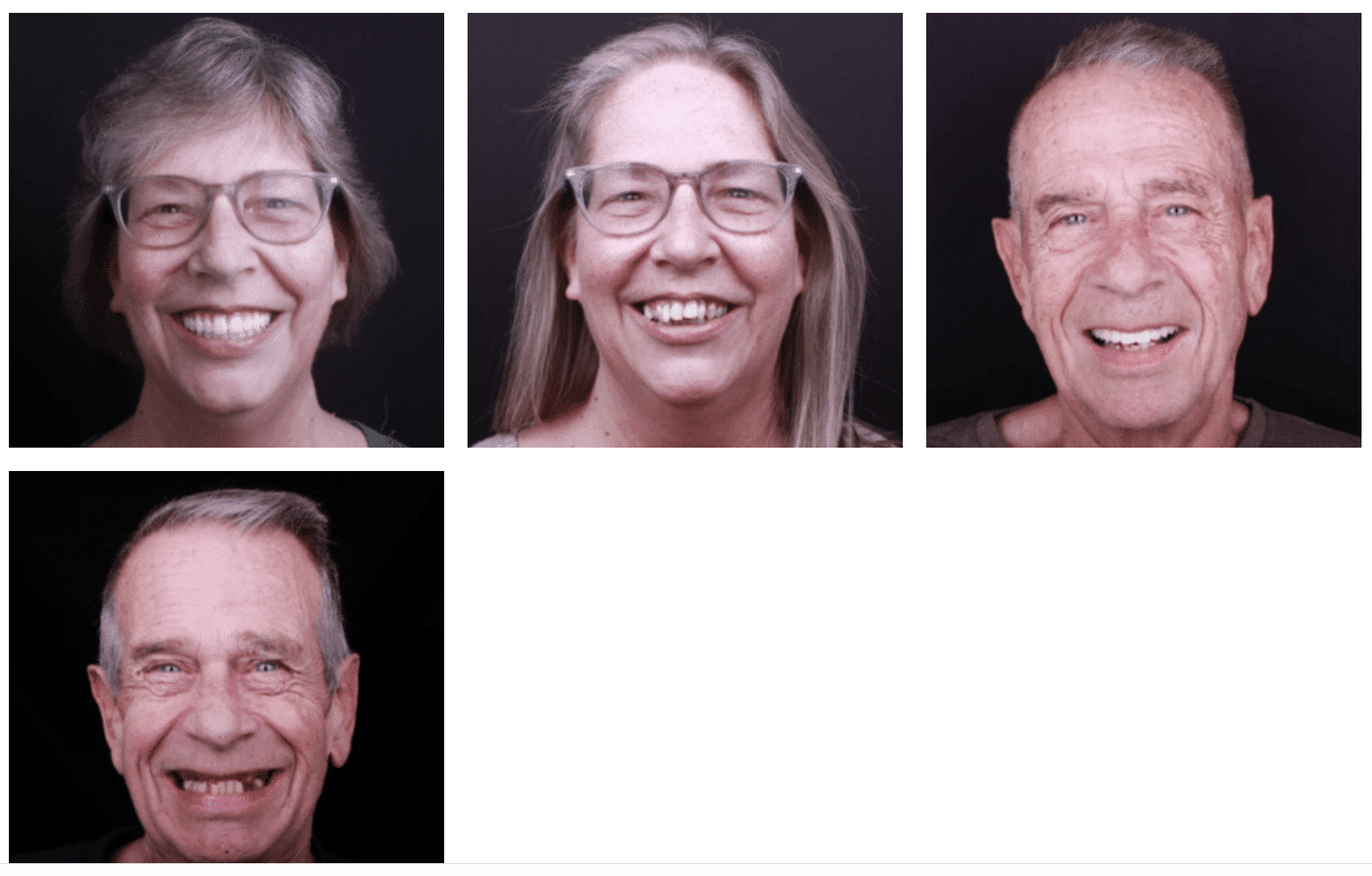 Benefits of full mouth dental implants 4 A collage of a man and woman