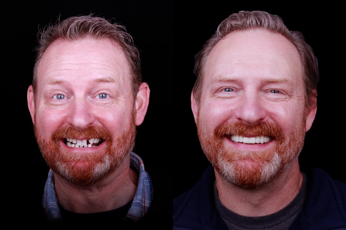 Before and after headshots david